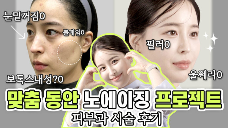노에이징 썸네일 광명