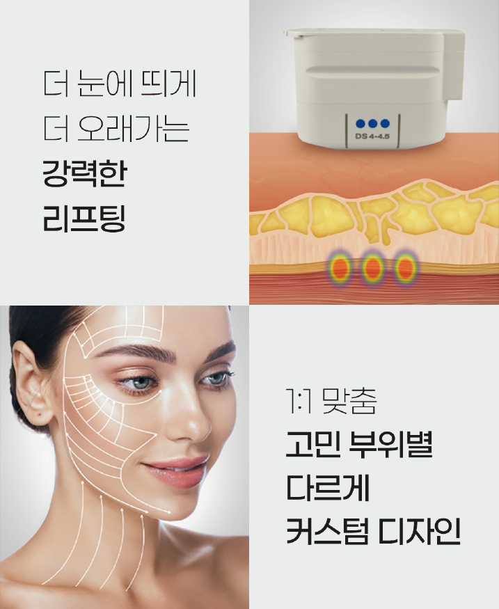 커스텀 울쎄라 상세페이지 분할 3
