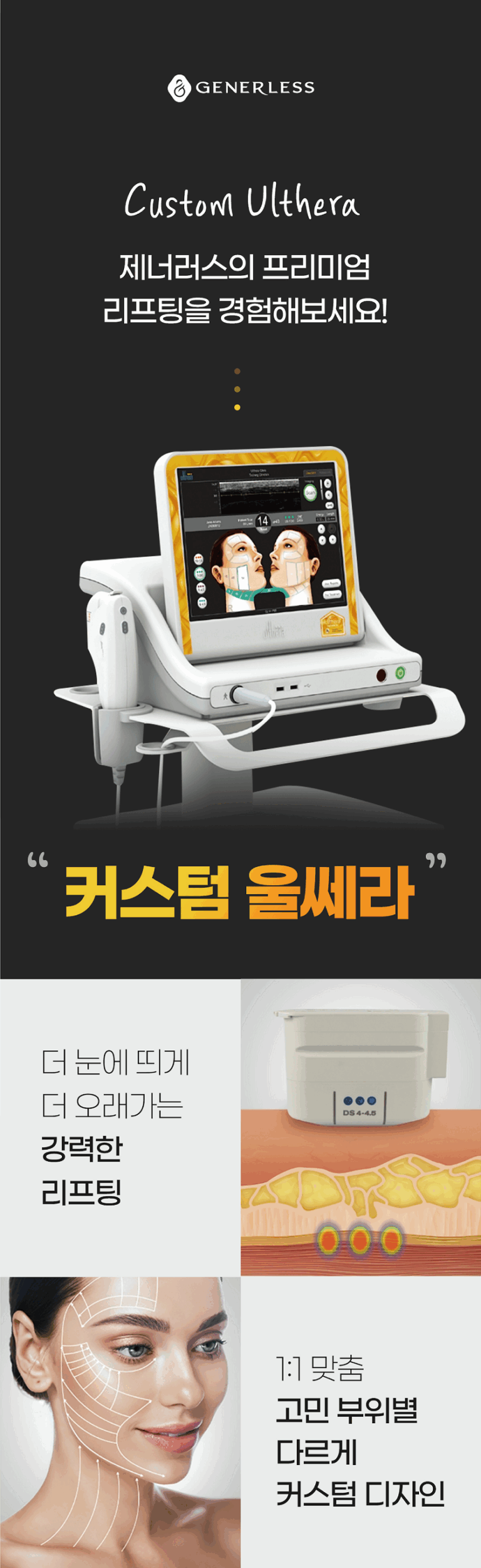 커스텀 울쎄라 천호 상세페이지 분할3